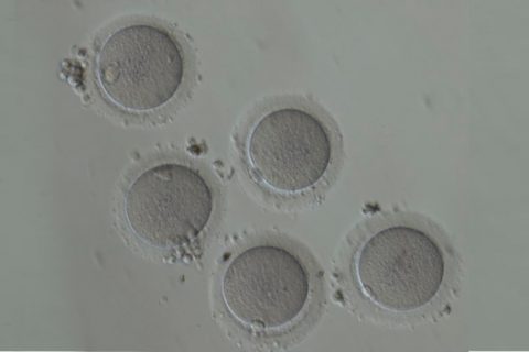 Criopreservação de óvulos